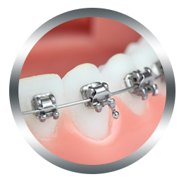 evernew-brackets2